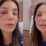 Após cirurgia, Ivete Sangalo aparece em hospital e revela problema de saúde (Foto: Reprodução)