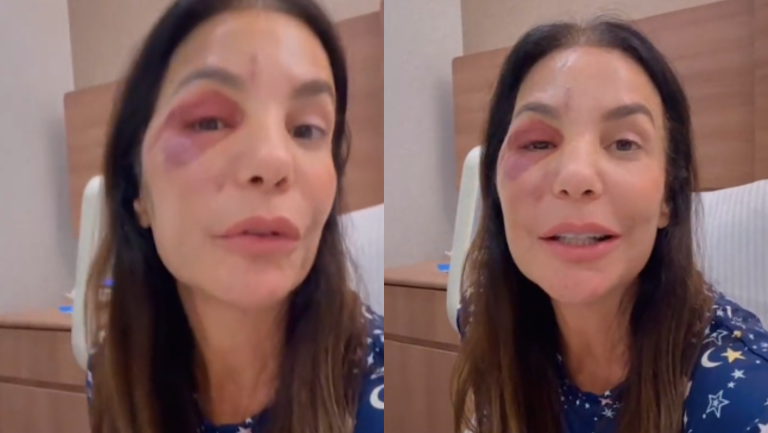 Após cirurgia, Ivete Sangalo aparece em hospital e revela problema de saúde (Foto: Reprodução)